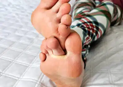 Brimful of soles